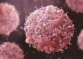 Ogogo’s Death: Oncologist Warns Nigerians Against Ignoring Cancer Symptoms