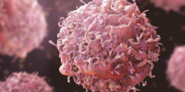 Ogogo’s Death: Oncologist Warns Nigerians Against Ignoring Cancer Symptoms