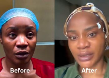 “I Don’t Like How I Look” – Uche Ogbodo Shares Facial Rejuvenation Update