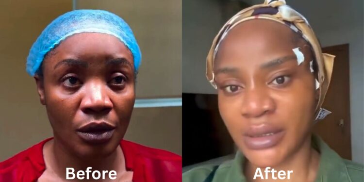 “I Don’t Like How I Look” – Uche Ogbodo Shares Facial Rejuvenation Update