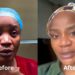 “I Don’t Like How I Look” – Uche Ogbodo Shares Facial Rejuvenation Update